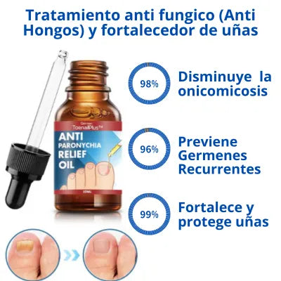 Tratamiento Antihongos para Uñas