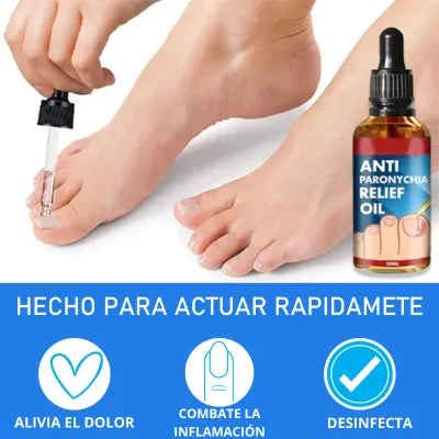 Tratamiento Antihongos para Uñas